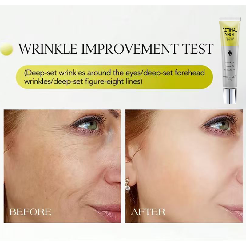 Retinal 0,1% – intensywnie dzi – The Ordinary Serum Hyaluronic Acid recenzja i cena